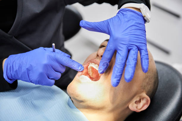 Best Emergency Treatment for Dental Infections or Abscesses in University Park, TX