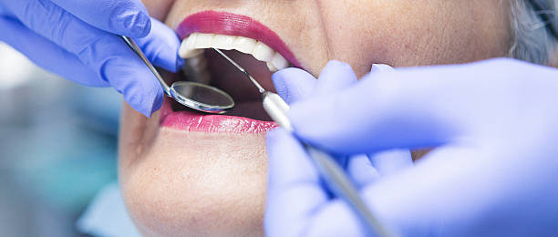 Best Emergency Denture Repair in University Park, TX